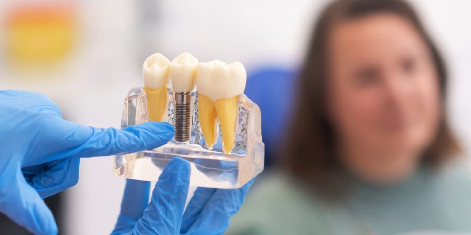 8 Signs You May Need Dental Implants: A Comprehensive Guide